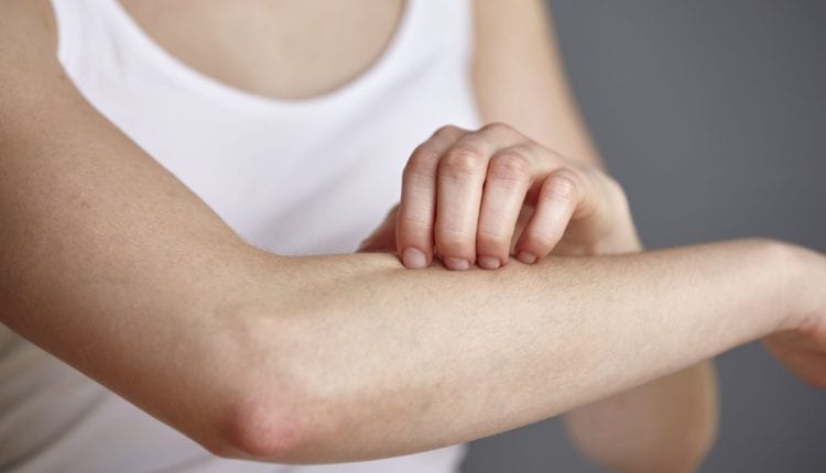 استخدامات كريم كورتيدرم Cortiderm Cream